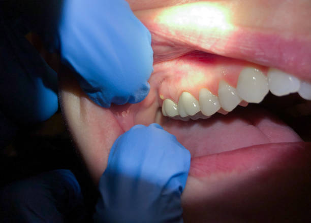 Best After-Hours Emergency Dentist in Eleanor, WV